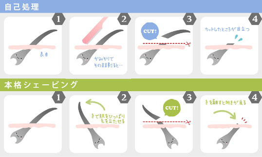 シェービング比較図