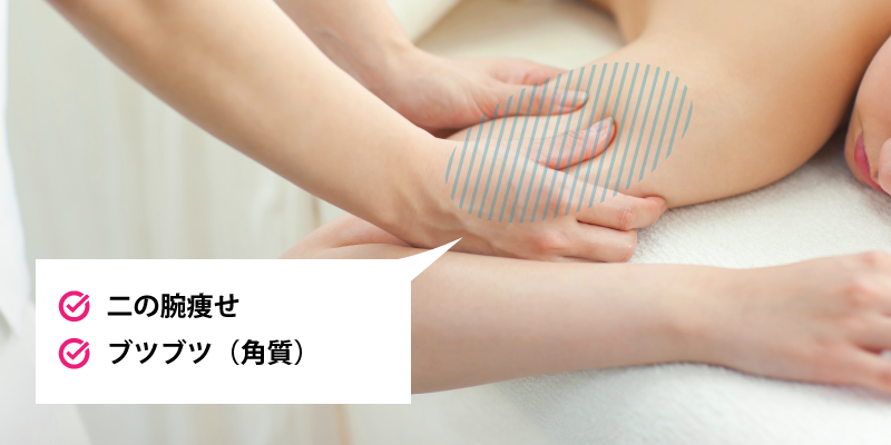 ブライダルエステ(二の腕)