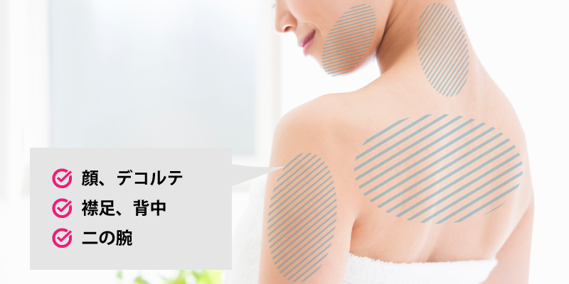 ブライダルエステ(シェービング)